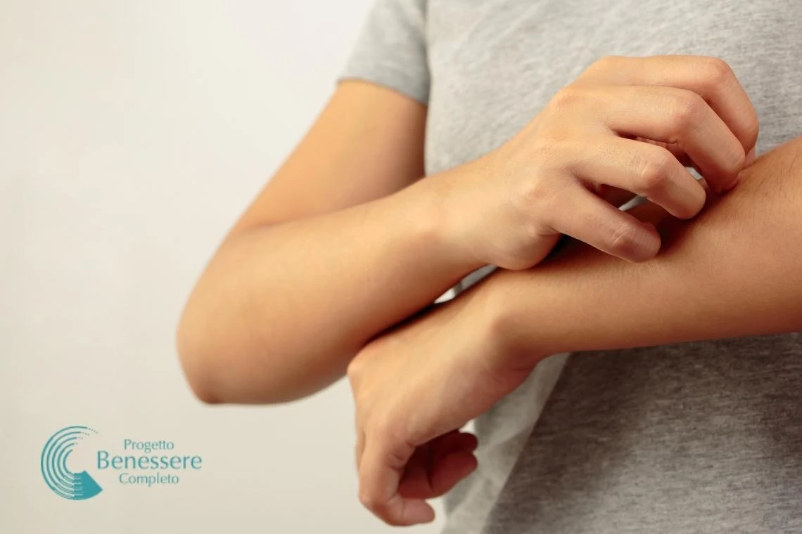 Orticaria: alla radice di questo prurito fastidioso